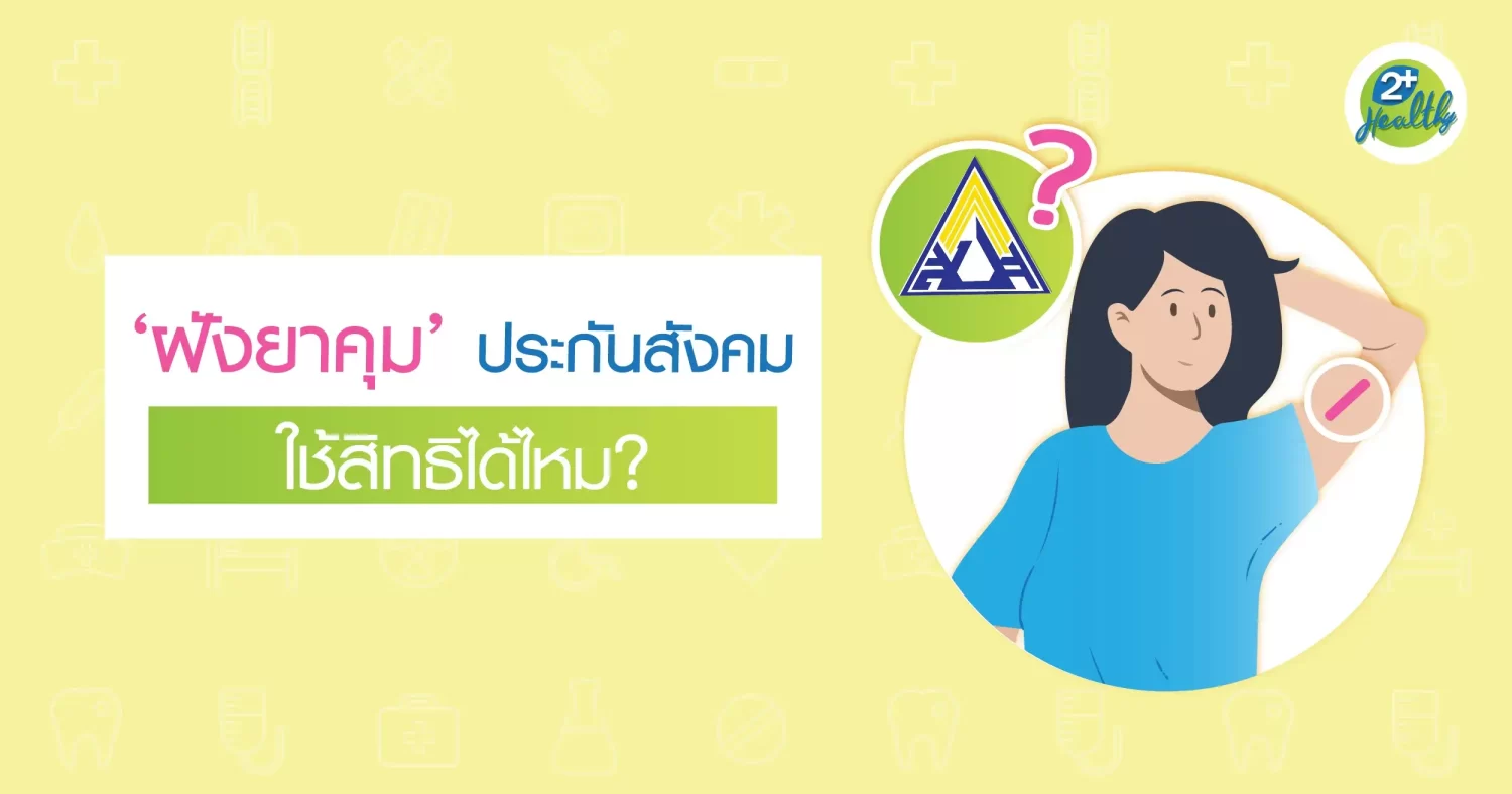 ฝังยาคุม ประกันสังคม ใช้สิทธิได้ไหม?