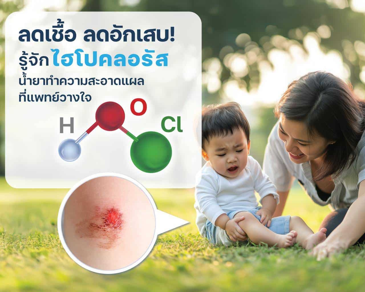 สารละลายไฮโปคลอรัส