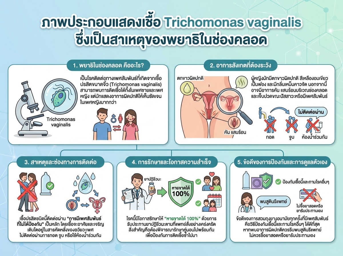 ภาพประกอบแสดงเชื้อ Trichomonas vaginalis ซึ่งเป็นสาเหตุของพยาธิในช่องคลอด