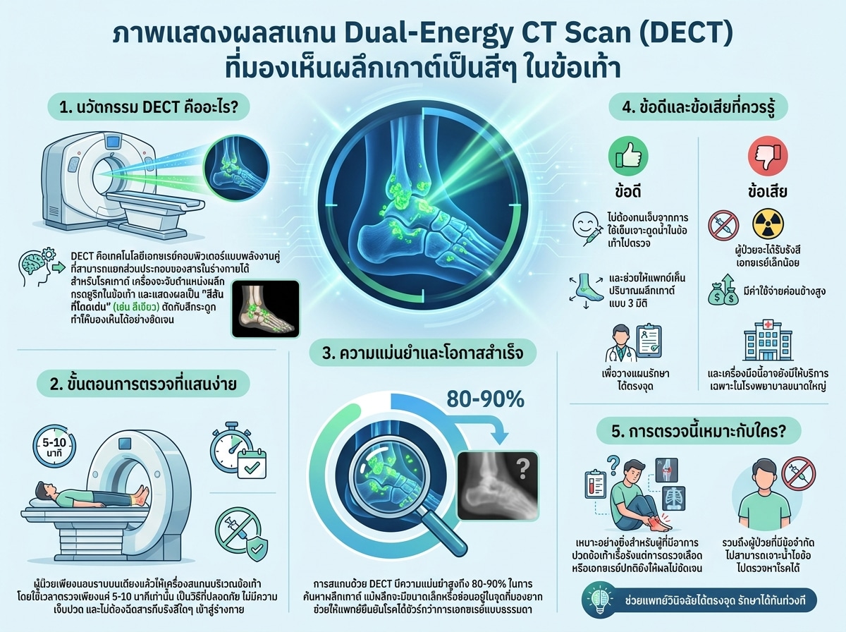 ภาพแสดงผลสแกน Dual-Energy CT Scan (DECT) ที่มองเห็นผลึกเกาต์เป็นสีๆ ในข้อเท้า