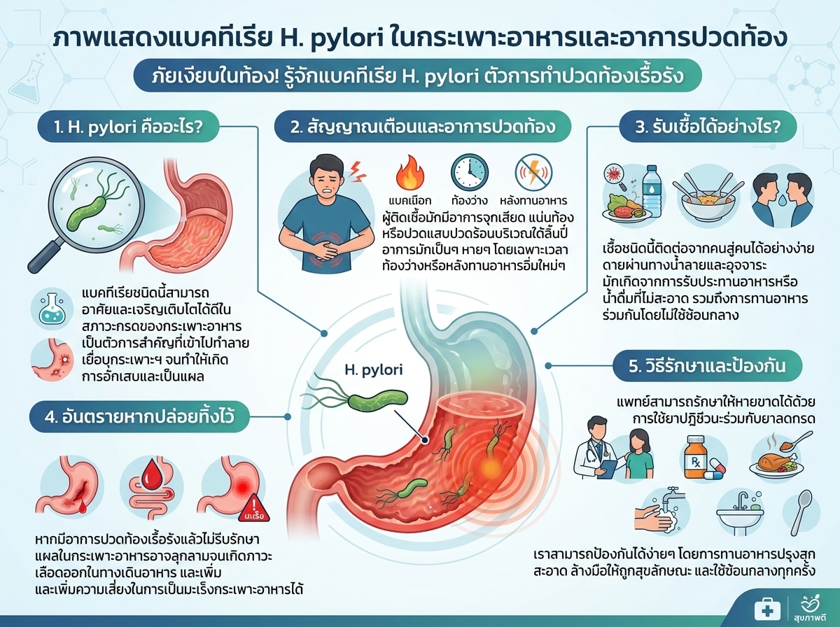 ภาพแสดงแบคทีเรีย H. pylori ในกระเพาะอาหารและอาการปวดท้อง