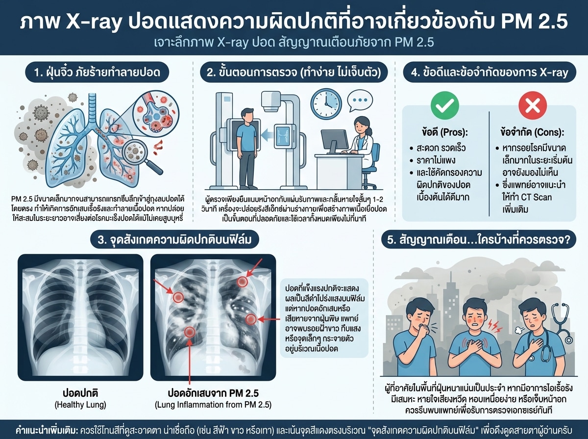 ภาพ X-ray ปอดแสดงความผิดปกติที่อาจเกี่ยวข้องกับ PM 2.5
