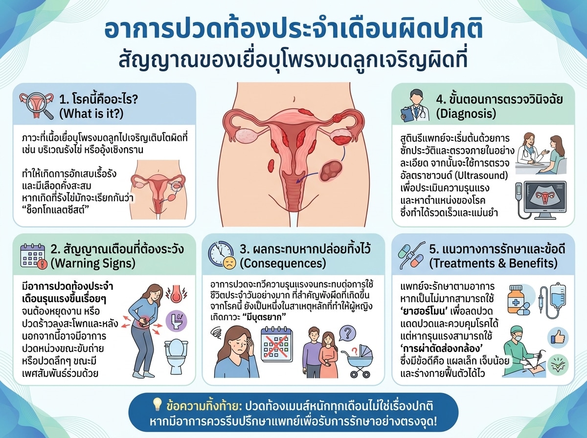 อาการปวดท้องประจำเดือนผิดปกติ สัญญาณของเยื่อบุโพรงมดลูกเจริญผิดที่