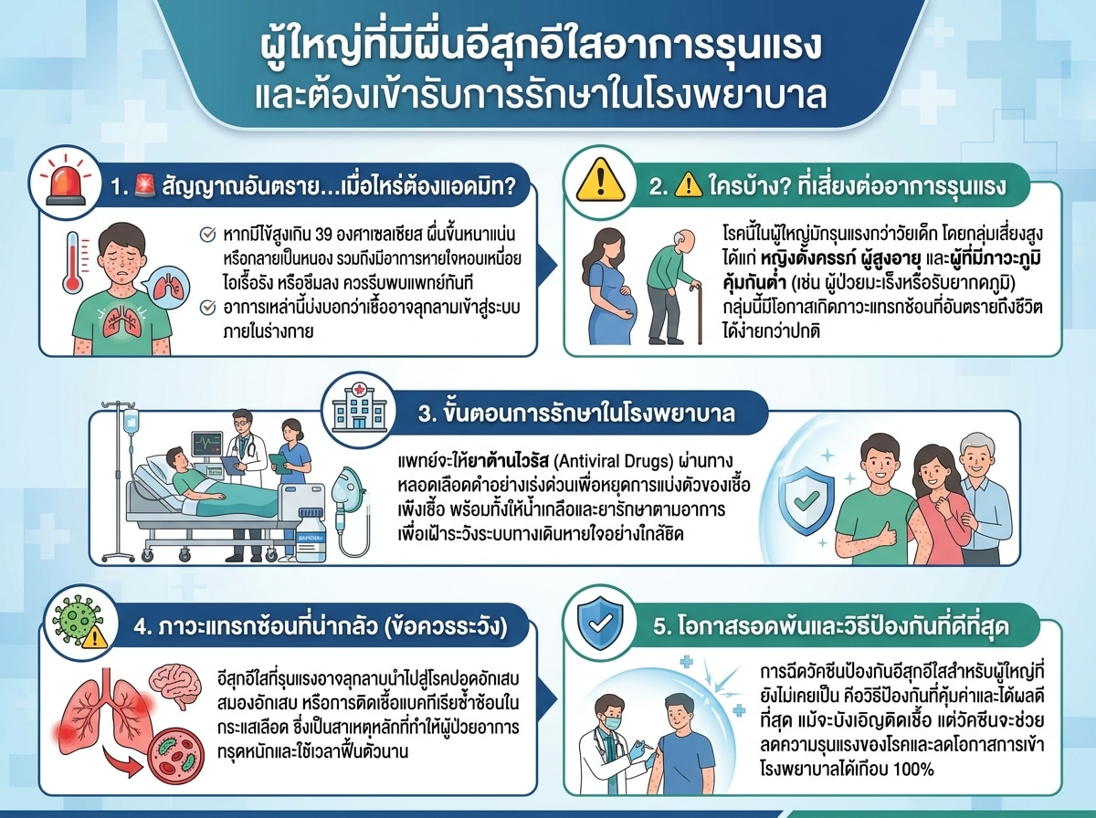 ผู้ใหญ่ที่มีผื่นอีสุกอีใสอาการรุนแรงและต้องเข้ารับการรักษาในโรงพยาบาล