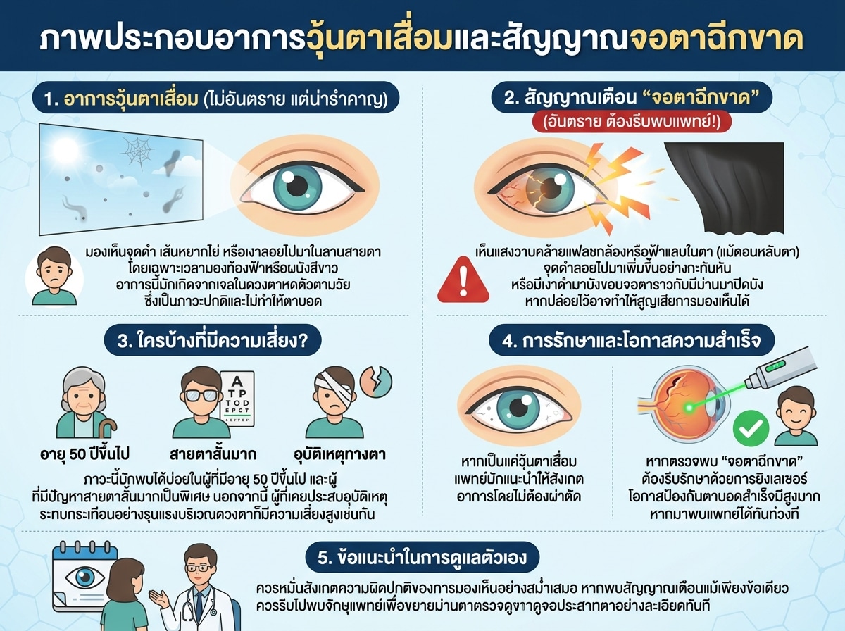 ภาพประกอบอาการวุ้นตาเสื่อมและสัญญาณจอตาฉีกขาด