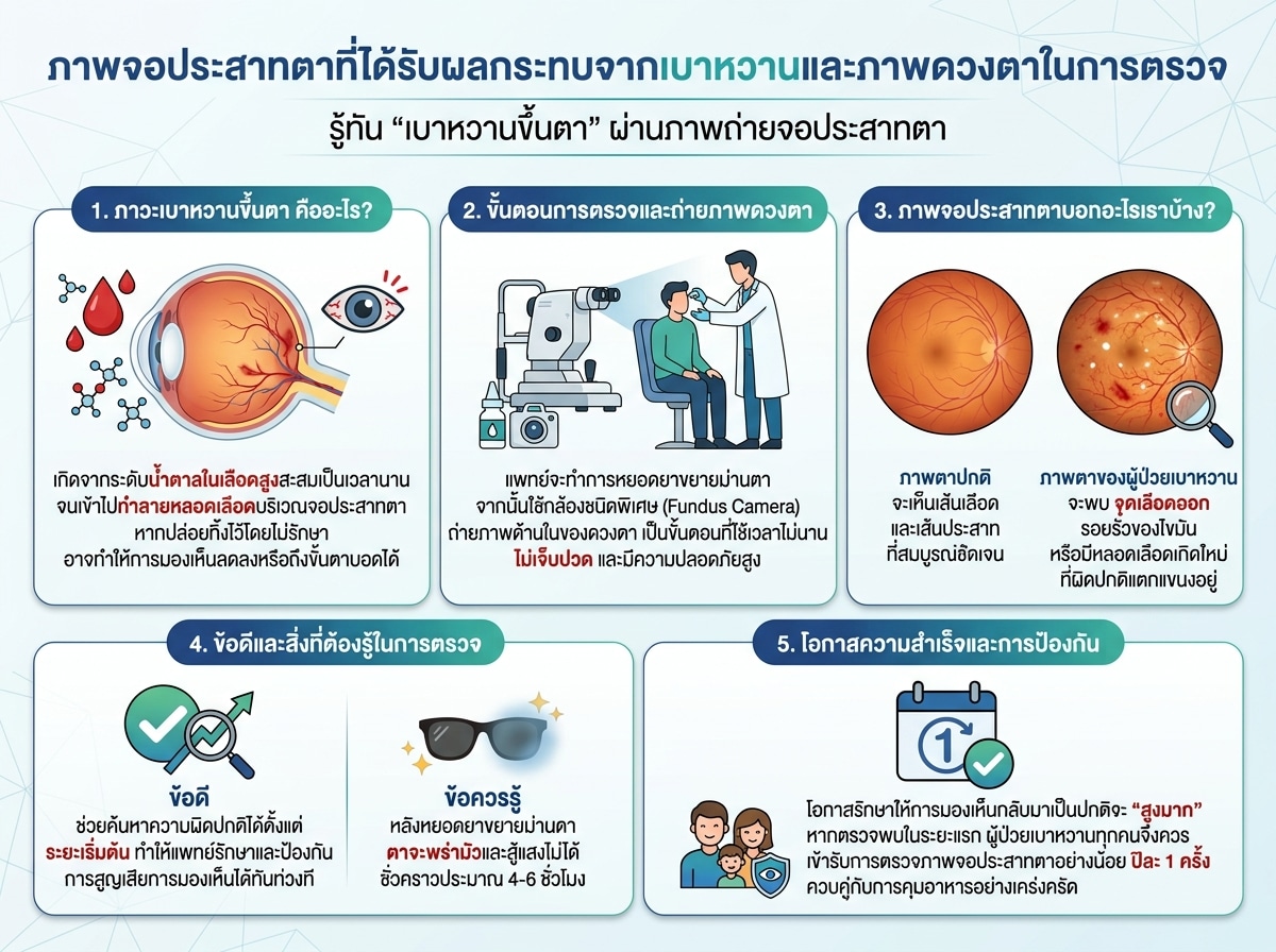ภาพจอประสาทตาที่ได้รับผลกระทบจากเบาหวานและภาพดวงตาในการตรวจ