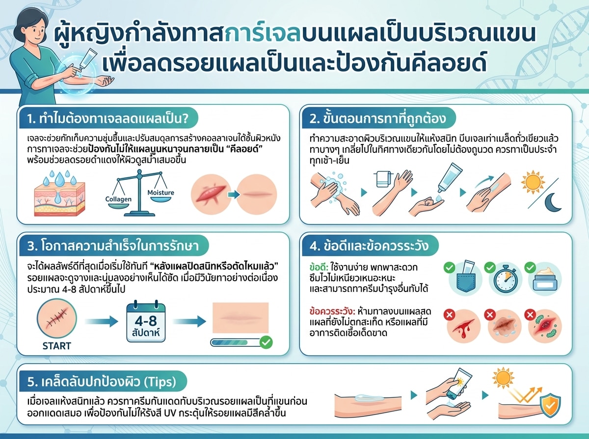 ผู้หญิงกำลังทาสการ์เจลบนแผลเป็นบริเวณแขนเพื่อลดรอยแผลเป็นและป้องกันคีลอยด์