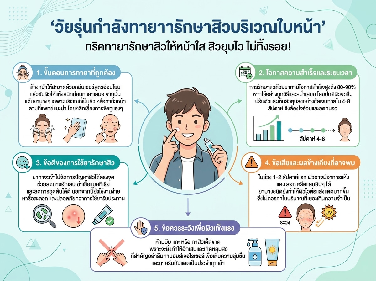 วัยรุ่นกำลังทายาทารักษาสิวบริเวณใบหน้า