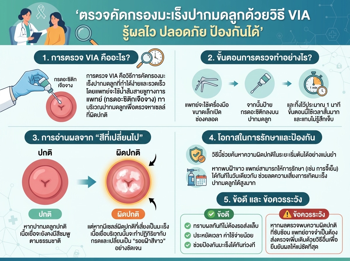 ผู้หญิงกำลังเข้ารับการตรวจ VIA เพื่อคัดกรองมะเร็งปากมดลูก ด้วยการทากรดอะซิติกบนปากมดลูกและสังเกตการเปลี่ยนแปลงของสี