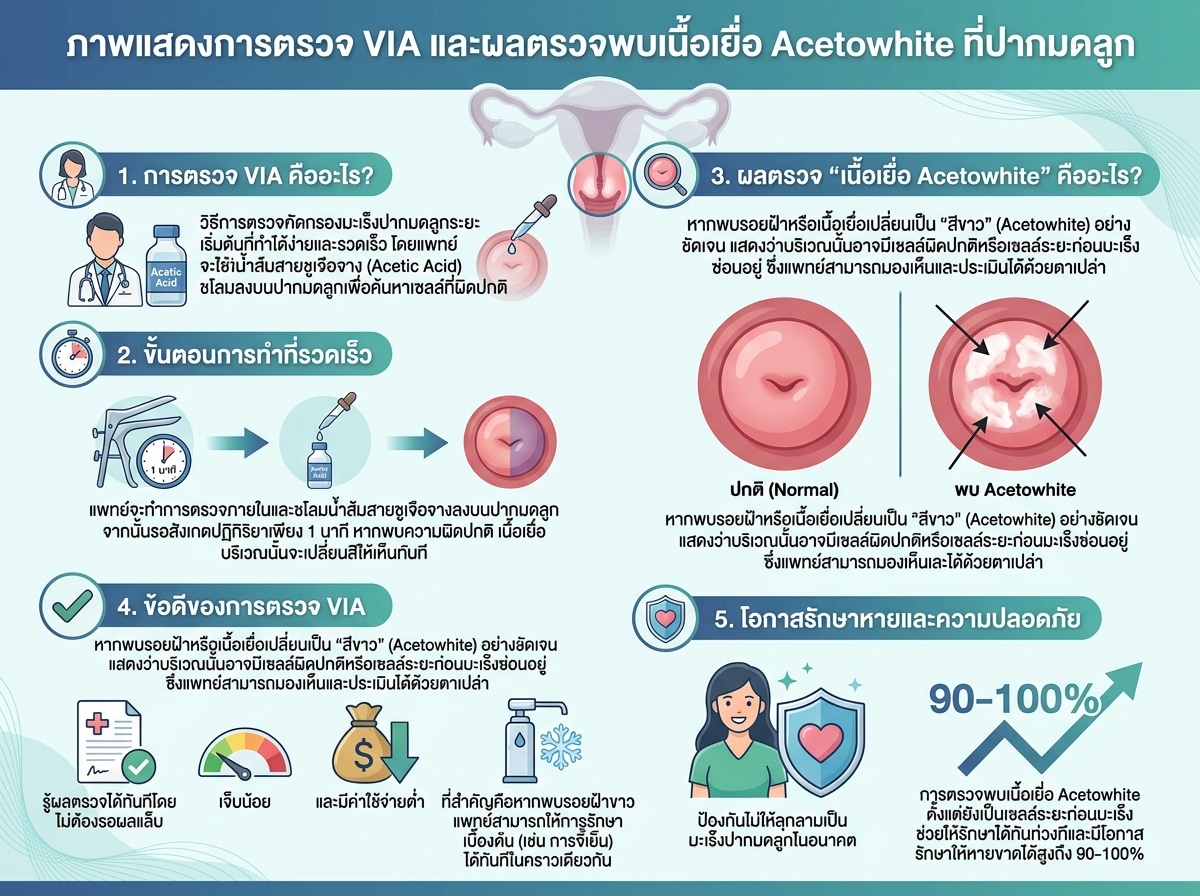 ภาพแสดงการตรวจ VIA และผลตรวจพบเนื้อเยื่อ Acetowhite ที่ปากมดลูก