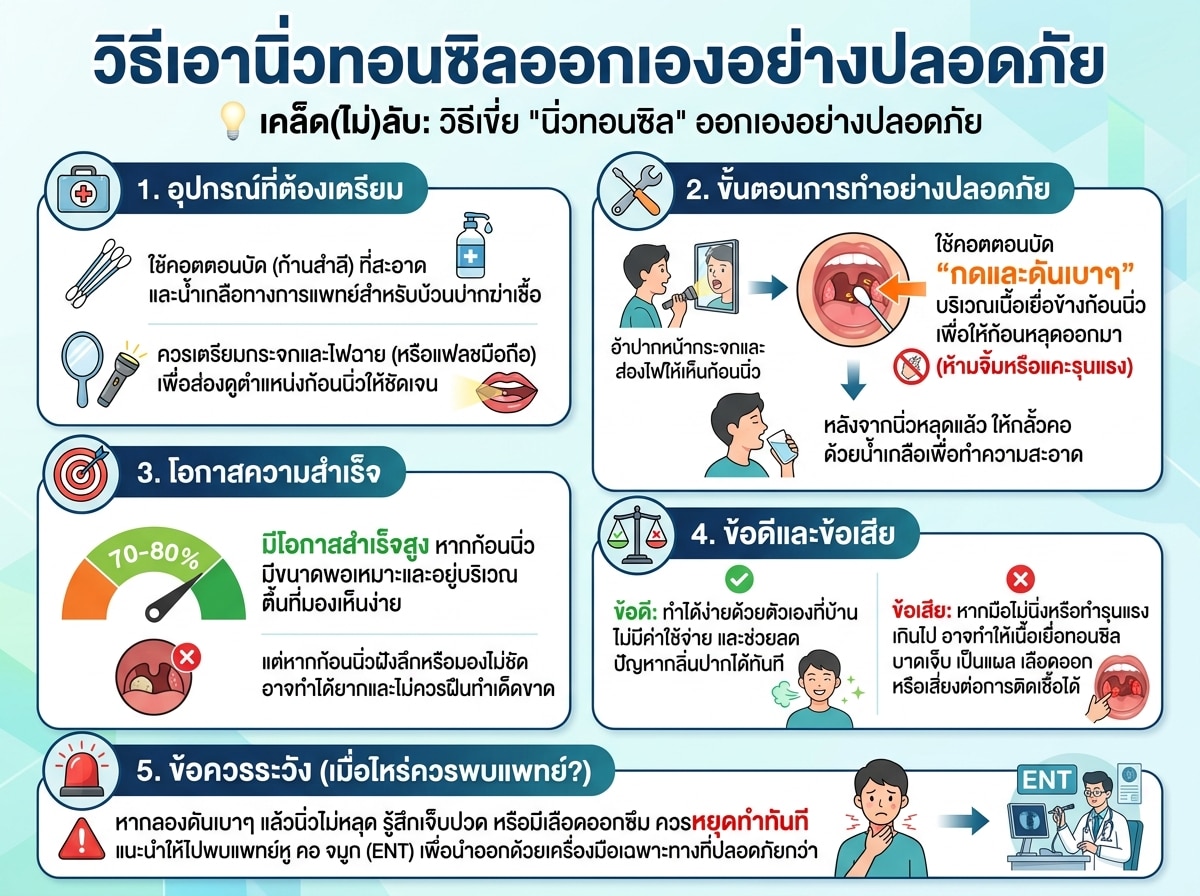วิธีเอานิ่วทอนซิลออกเองอย่างปลอดภัย
