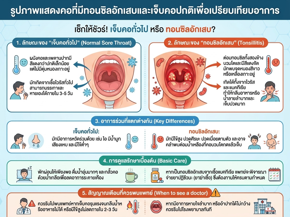 รูปภาพแสดงคอที่มีทอนซิลอักเสบและเจ็บคอปกติเพื่อเปรียบเทียบอาการ