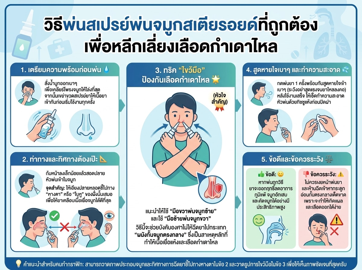 วิธีพ่นสเปรย์พ่นจมูกสเตียรอยด์ที่ถูกต้อง เพื่อหลีกเลี่ยงเลือดกำเดาไหล