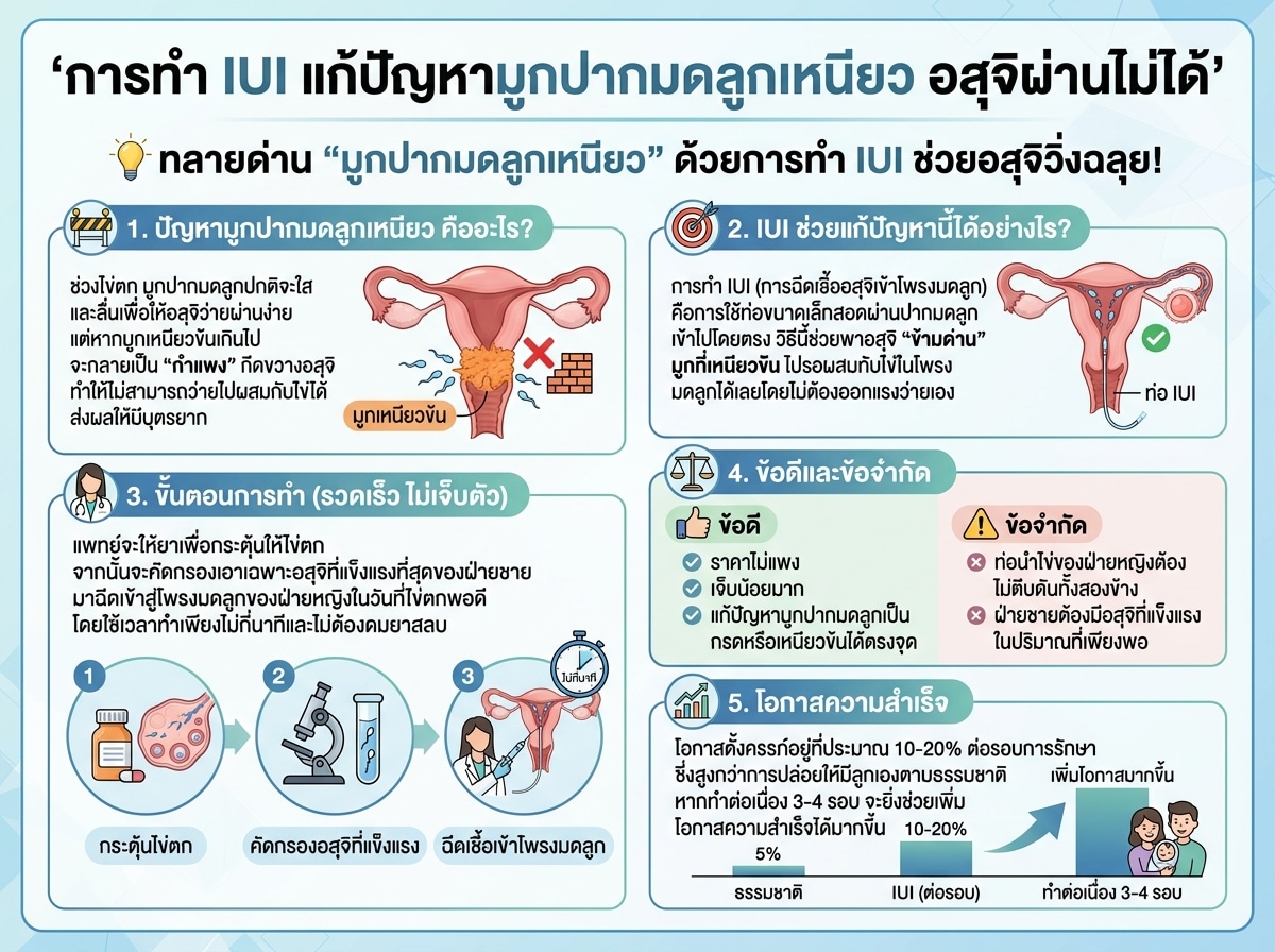 การทำ IUI แก้ปัญหามูกปากมดลูกเหนียว อสุจิผ่านไม่ได้